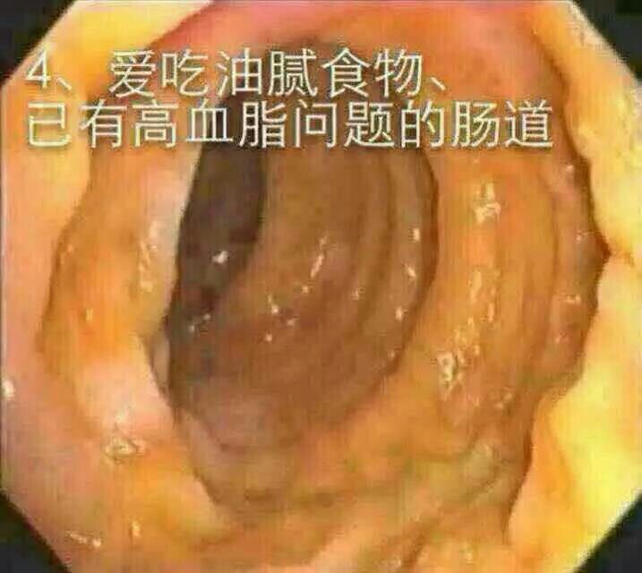 但却是真实的!便秘是万