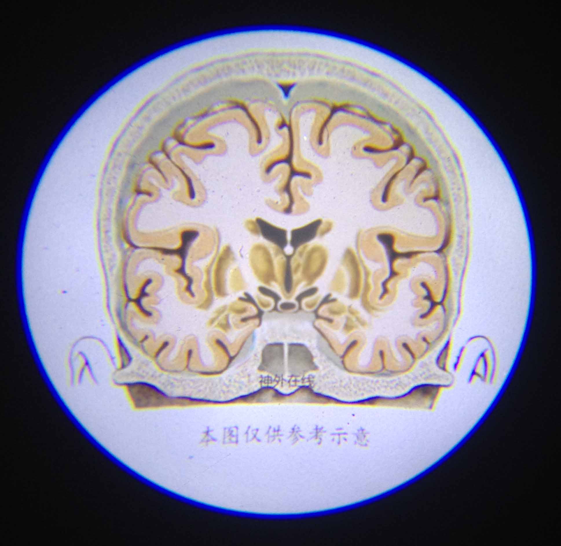 投影图案_冠状面1