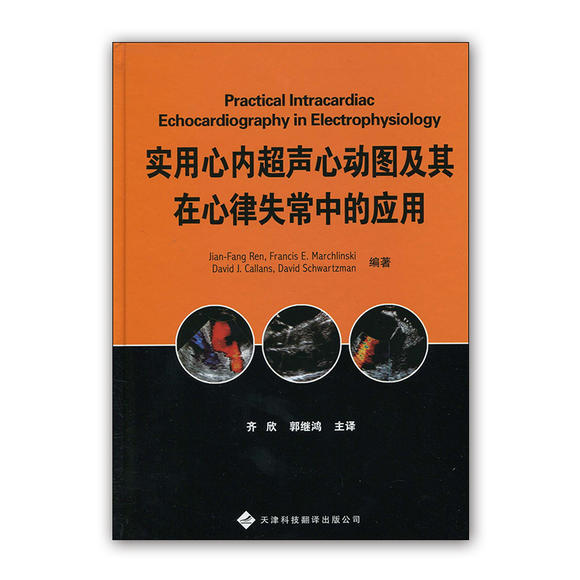 实用心内超声心动图及其在心律失常中的应用