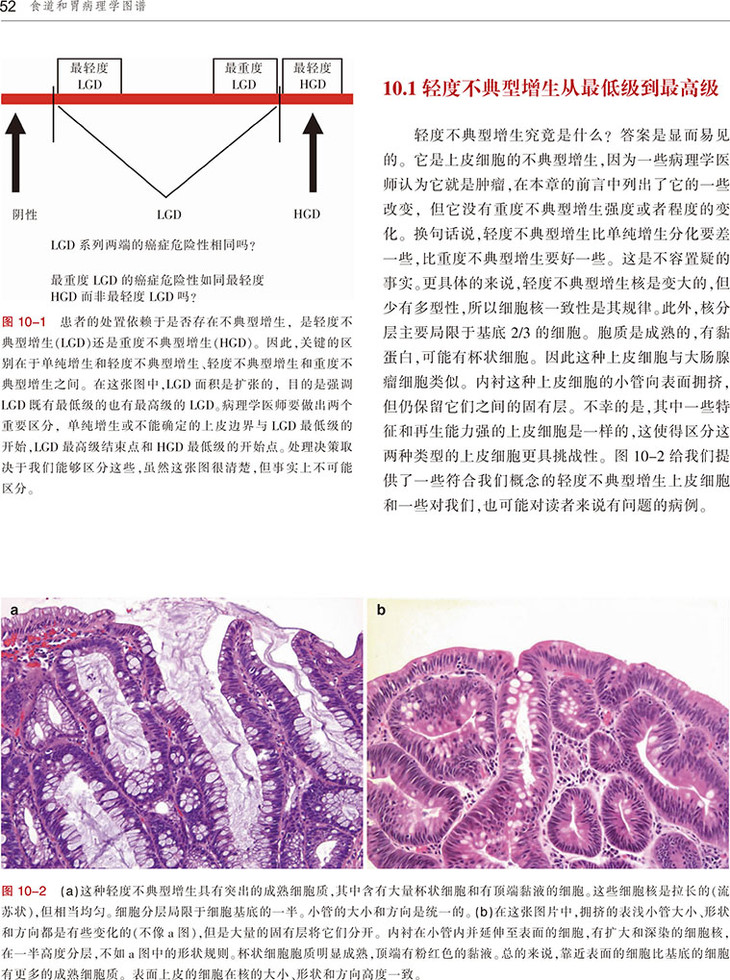 食道和胃病理学图谱