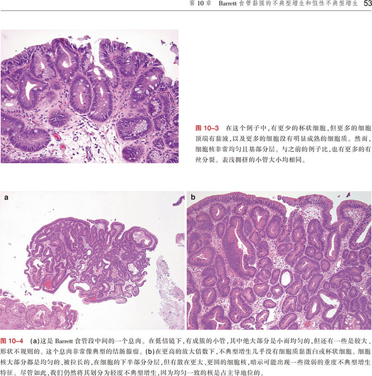 食道和胃病理学图谱