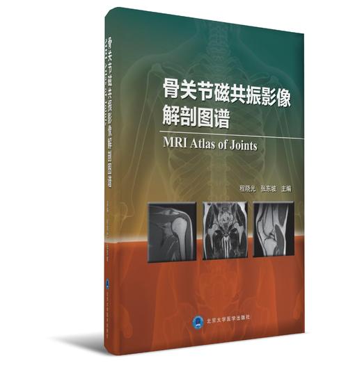 骨关节磁共振影像解剖图谱    主编：程晓光，张东坡    北医出版 商品图0