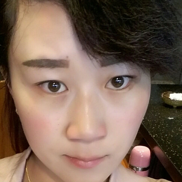 诗茵玻尿酸小酒窝