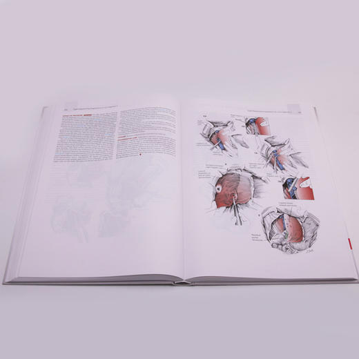【正版包邮】Zollinger外科手术图谱（第10版）（英文版） Zollinger’s Atlas of Surgical Operations 商品图4