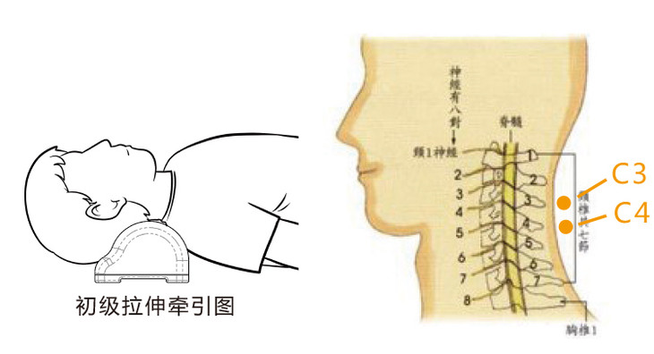 安胜舒展器套餐(缓解颈椎肌肉 韧带疲劳 预防颈椎病 )