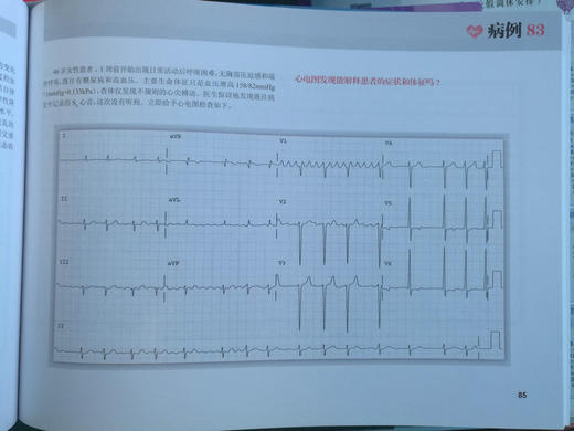 波德瑞德（Podrid）临床心电图解析 1-4卷（5分册） 商品图8