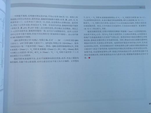 波德瑞德（Podrid）临床心电图解析 1-4卷（5分册） 商品图10