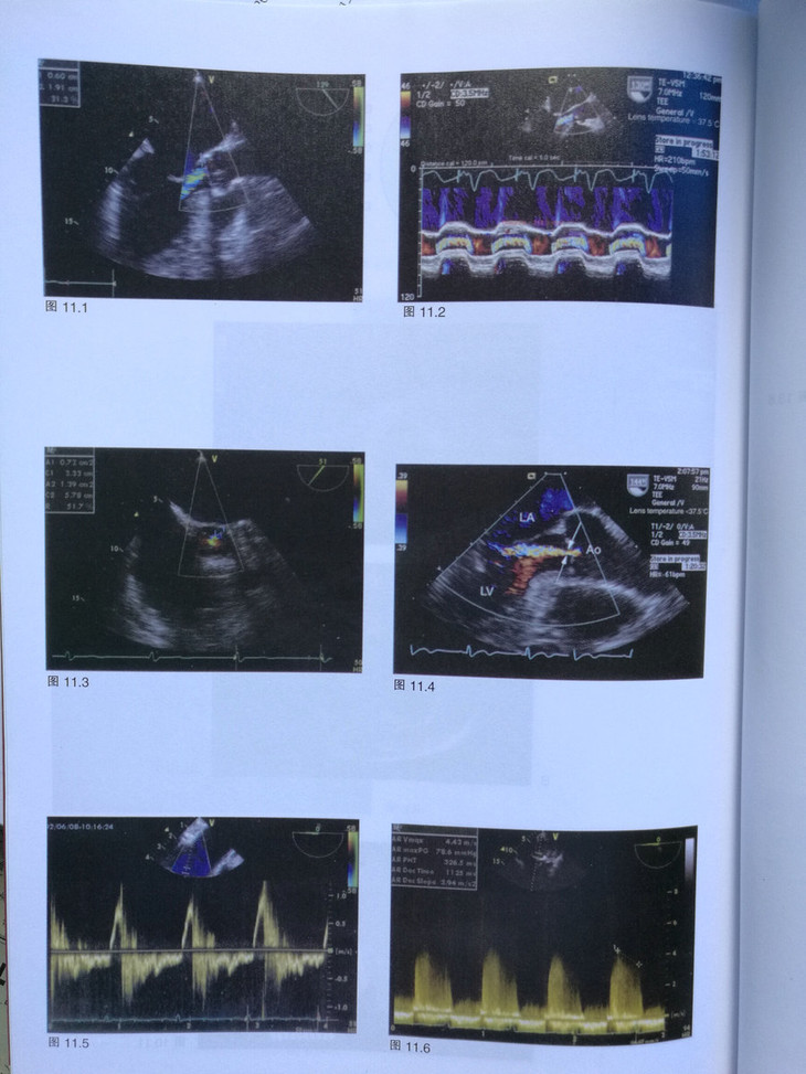 经食管超声心动图实用技术