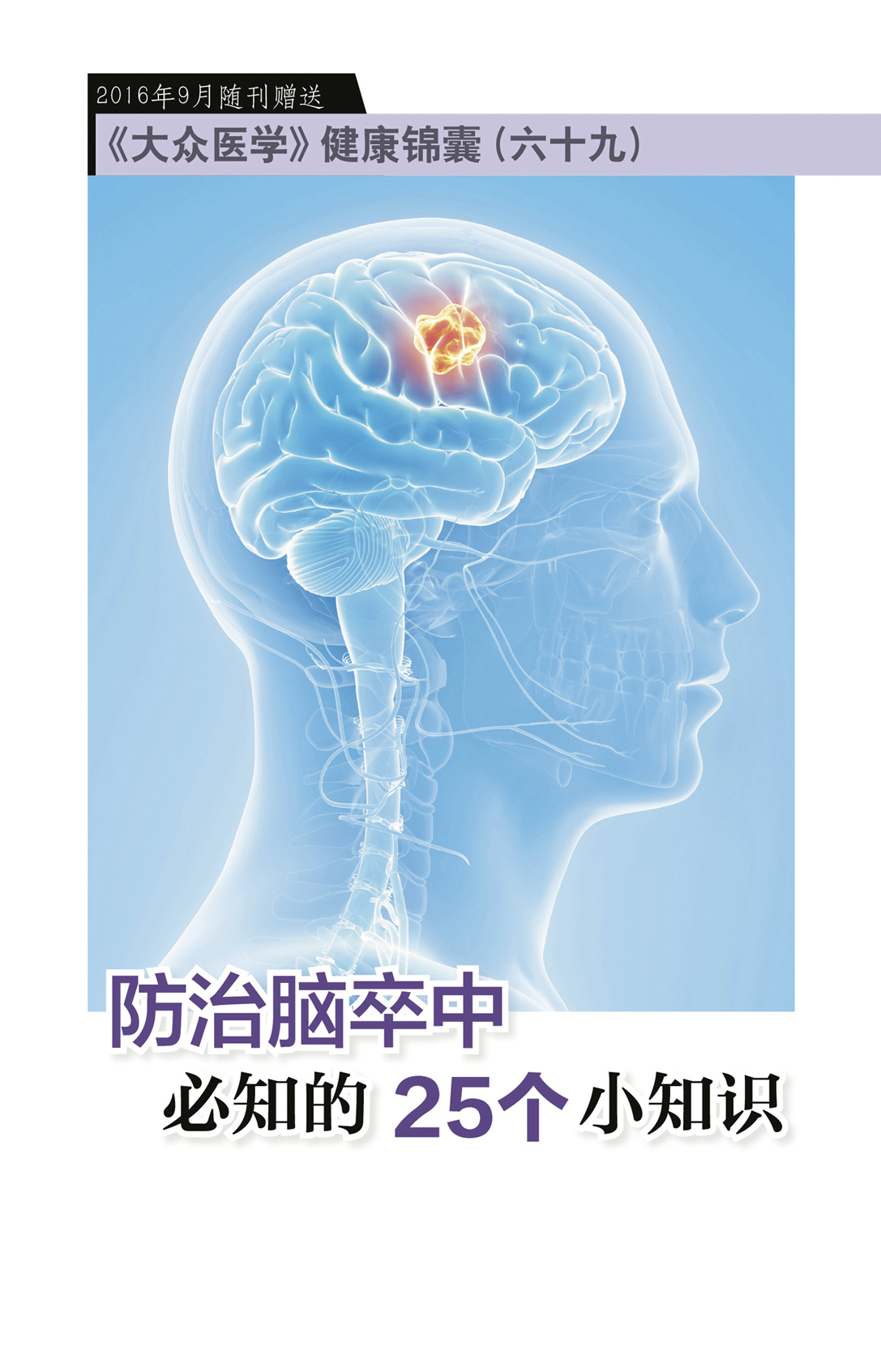  防治脑卒中必知的25个小知识