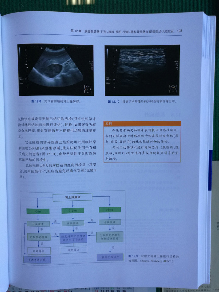 介入性超声实践指南和图谱
