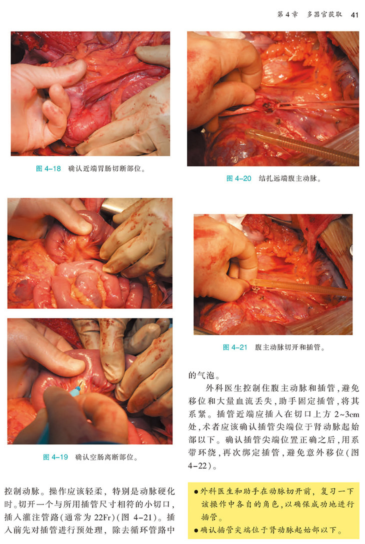 腹部器官获取及修整