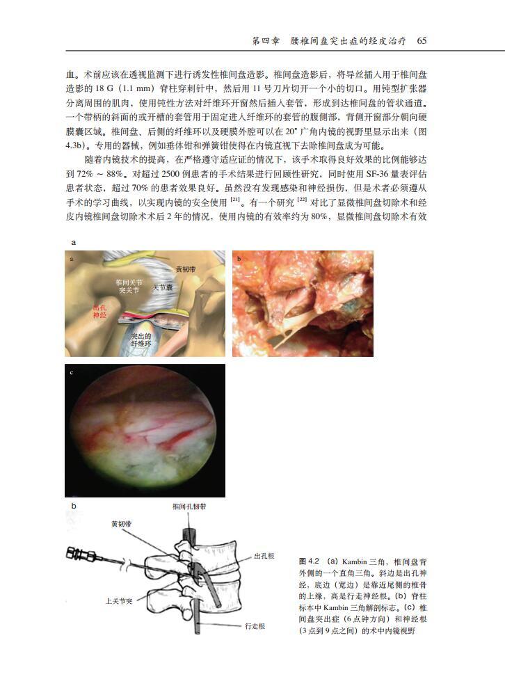 第十二章 椎体强化术治疗骨质疏松性椎体压缩骨折 第十三章 骶髂关节