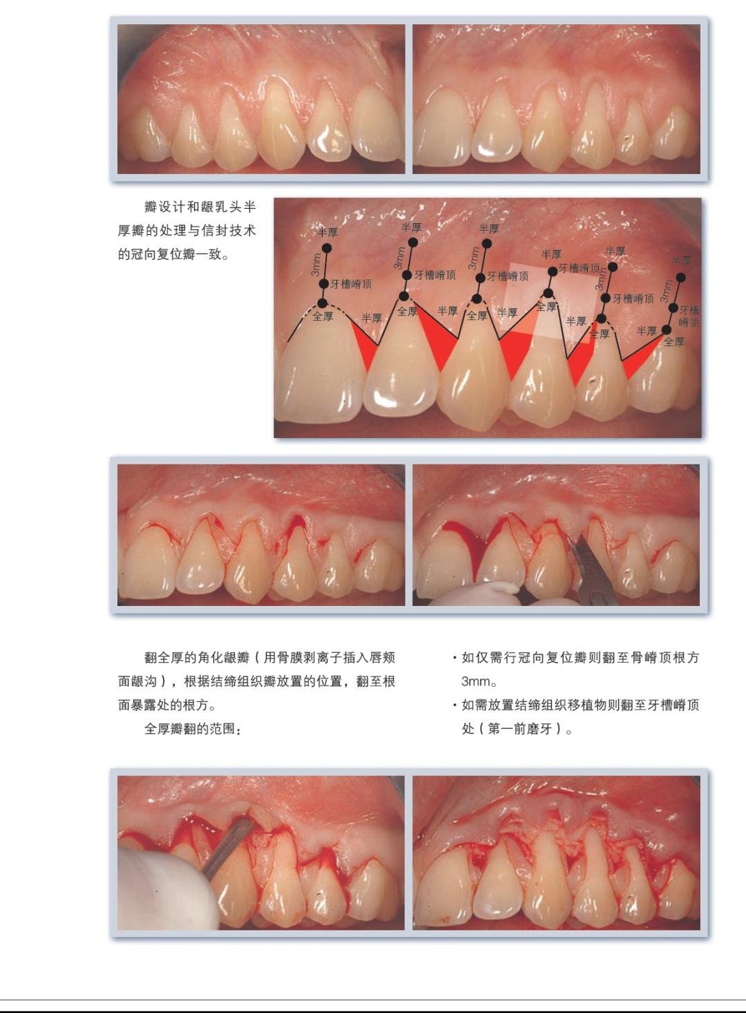 膜龈美学手术精要 - kq88口腔商城