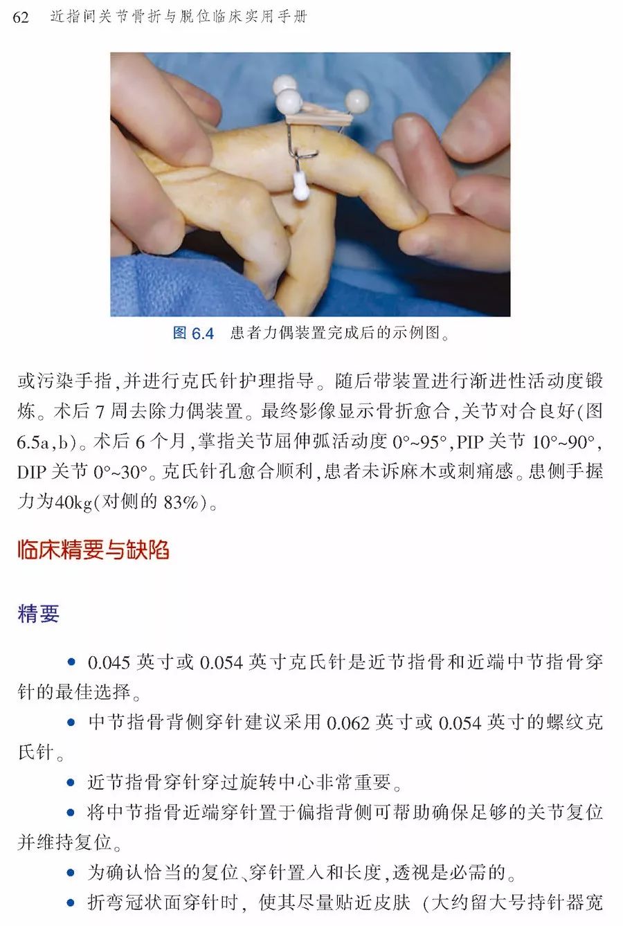 2018新书——近指间关节骨折与脱位临床实用手册