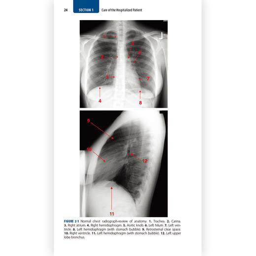 哈里森内科学手册（第19版）(英文版） 商品图2