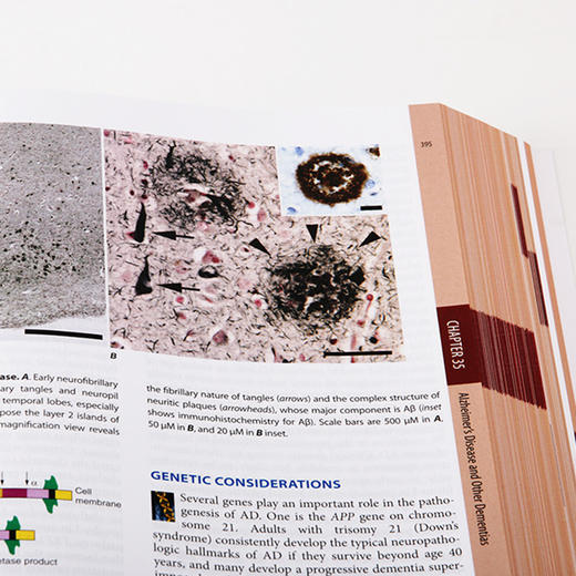 哈里森临床神经病学（第4版）(英文版) 商品图2