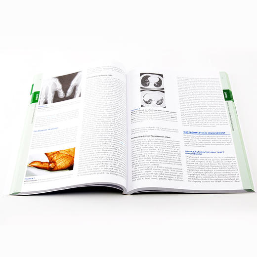 哈里森风湿病学（第4版）(英文版) 商品图2