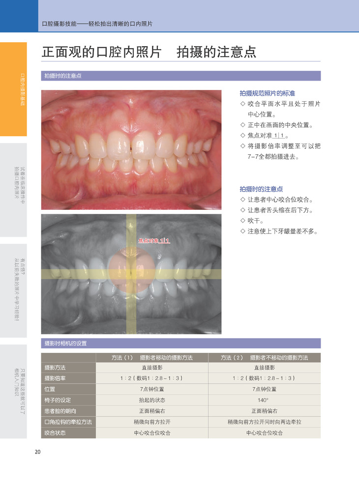 《口腔摄影技能》