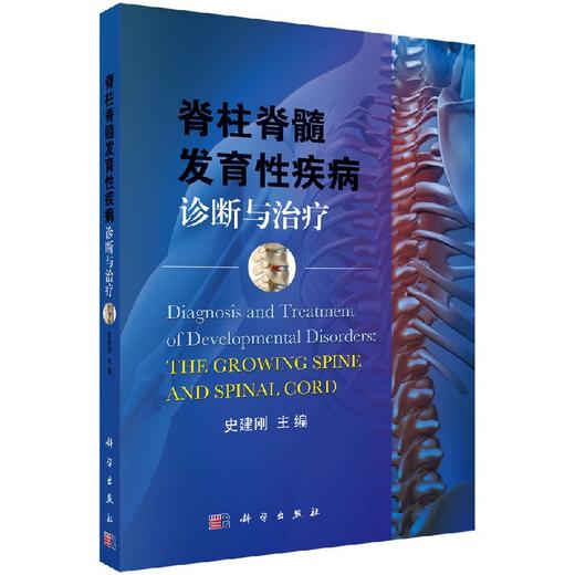 脊柱脊髓发育性疾病诊断与治疗 商品图0