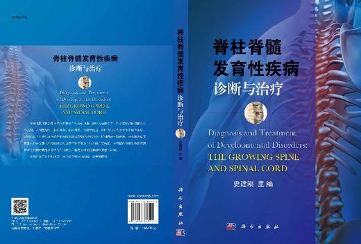 脊柱脊髓发育性疾病诊断与治疗 商品图3
