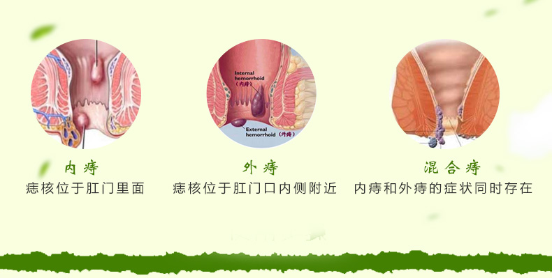 同仁堂 地榆槐角丸10丸 便秘便血 内痔外痔 肛裂痔疮