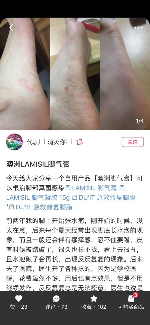 糜烂型,水泡型脚气都容易反反复复,问题比较严重的,一天可以用2次.