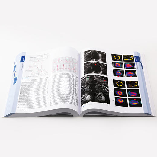 哈里森心血管内科学（第3版）(英文版) 商品图3