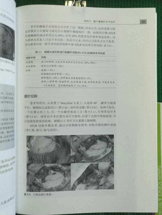 神经外科典型病例的难点与对策    主译：景治涛    天津科技翻译出版社 商品图2