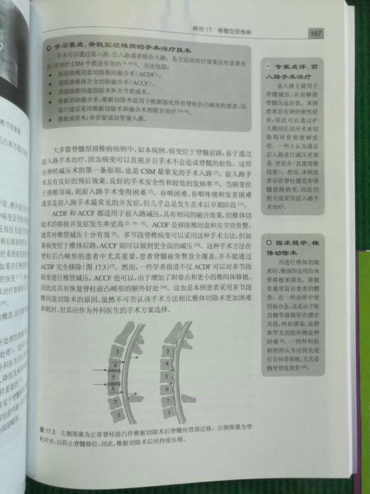 神经外科典型病例的难点与对策    主译：景治涛    天津科技翻译出版社 商品图4