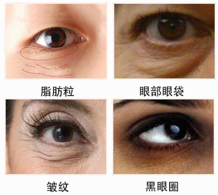 提拉紧致,促进眼部微循环 无需手术不动刀,淡化眼袋眼纹 而是珍贵的