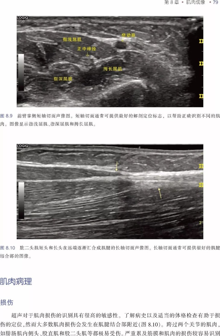 肌肉骨骼超声基础:入门篇