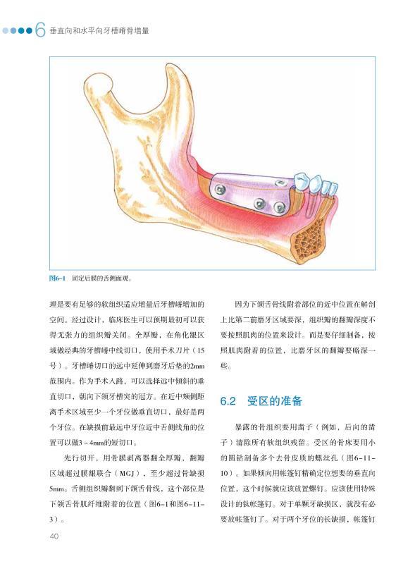 《垂直向和水平向牙槽嵴骨增量》