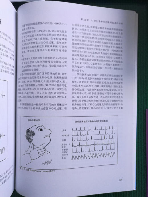 2018年新书：临床心脏病学图解速成讲授 商品图8