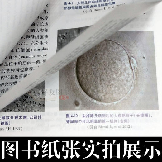 人类卵子学OVA 孙莹璞 相文佩主编 人民卫生出版社 商品图4