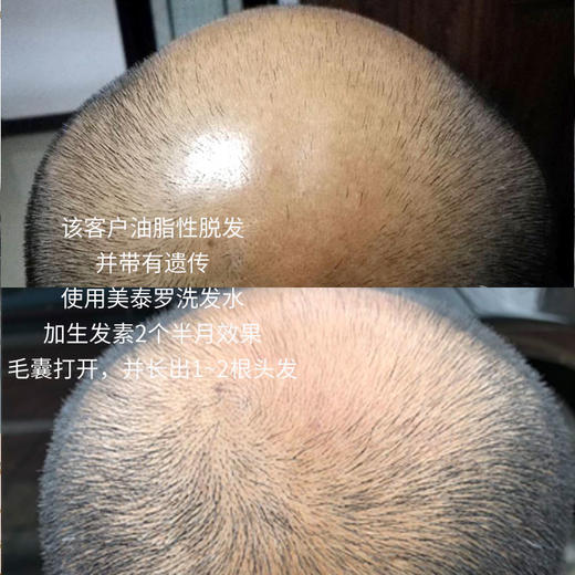 美泰罗头发滋养液 商品图3