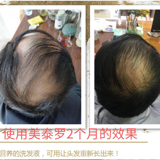美泰罗头发滋养液 商品图2