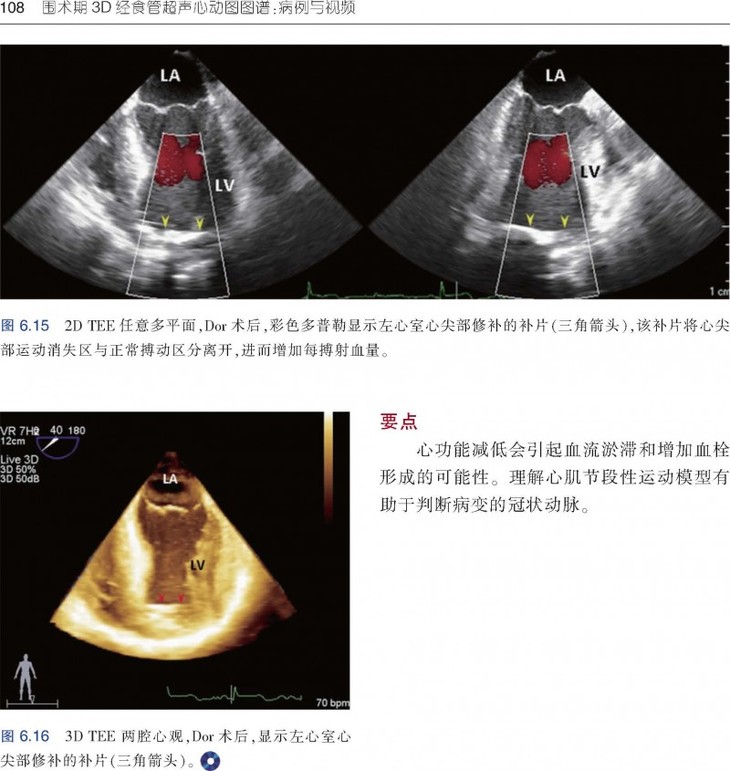 围术期3d经食管超声心动图图谱:病例与视频
