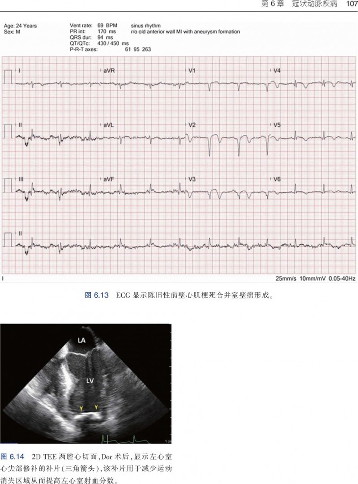 围术期3d经食管超声心动图图谱:病例与视频