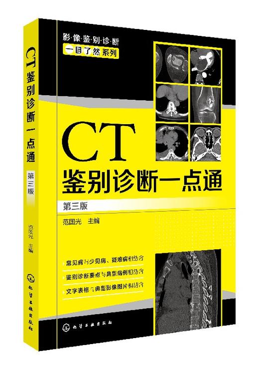 影像鉴别诊断一目了然系列--CT鉴别诊断一点通（第三版） 商品图0