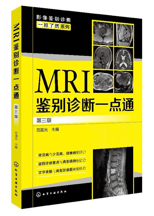 影像鉴别诊断一目了然系列--MRI鉴别诊断一点通（第三版） 商品图0