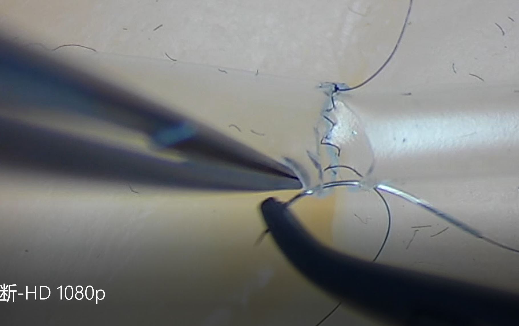 第五章 粗细对吻-先吻后闭