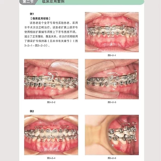 【现货】《实用口腔正畸临床技术图谱》