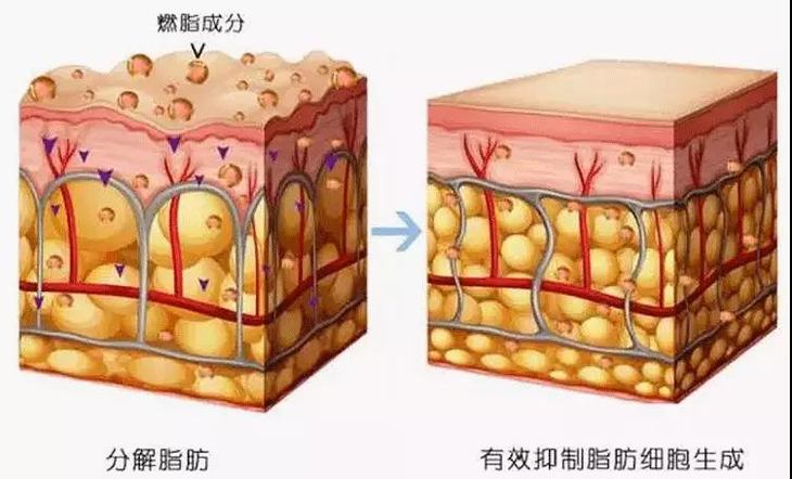 澳洲ypl瘦腿专业裤休闲控制运动工作都穿它不知不觉瘦身不睡眠住嘴哺乳期图片