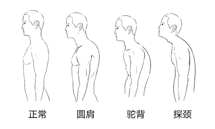 可殊不知,严重的不良体态已经把许多亚健康藏进了身体.