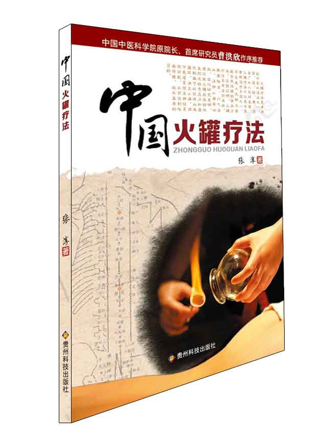 中国火罐疗法