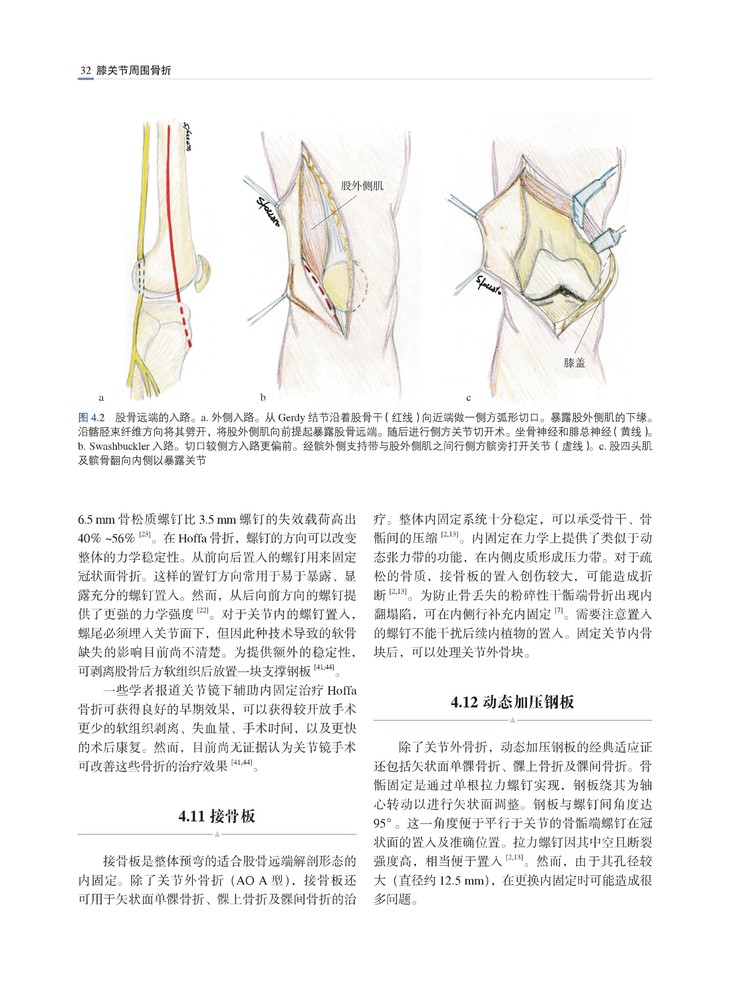 1 髌骨骨折 2 胫骨髁间棘撕脱骨折 3 股骨远端骨折(关节外)的管理 4