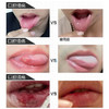 现货现发【拍1发1,拍2发3】泰国皇室御用口腔膏,纯植物提取,涂抹3次告别口腔问题! 商品缩略图2