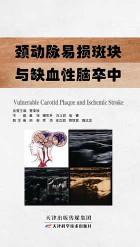 颈动脉易损斑块与缺血性脑卒中