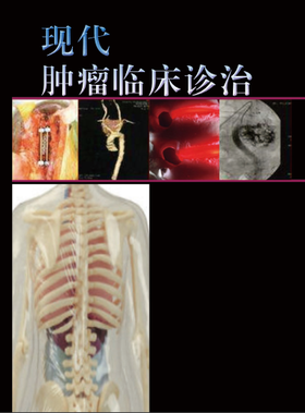 现代肿瘤临床诊治