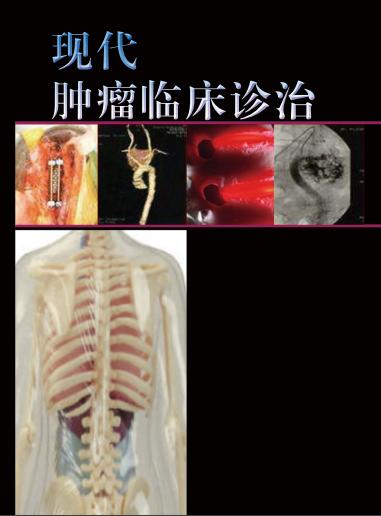 现代肿瘤临床诊治 商品图0